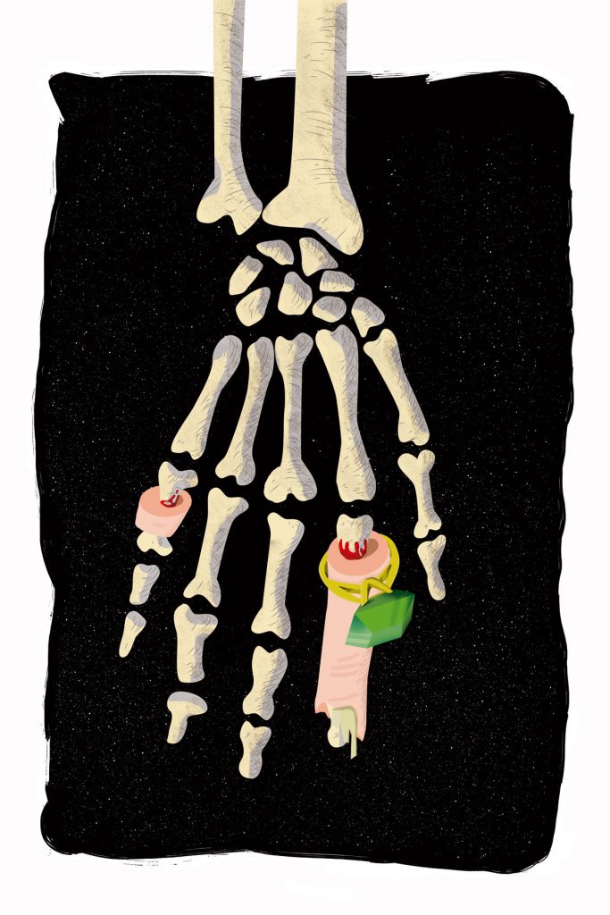 1_la_mano_muerta